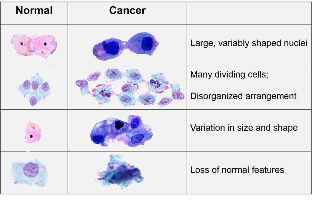 Characteristics of Cancer Cells